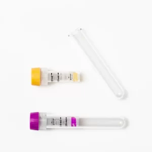 Bilirubin (Indirect)